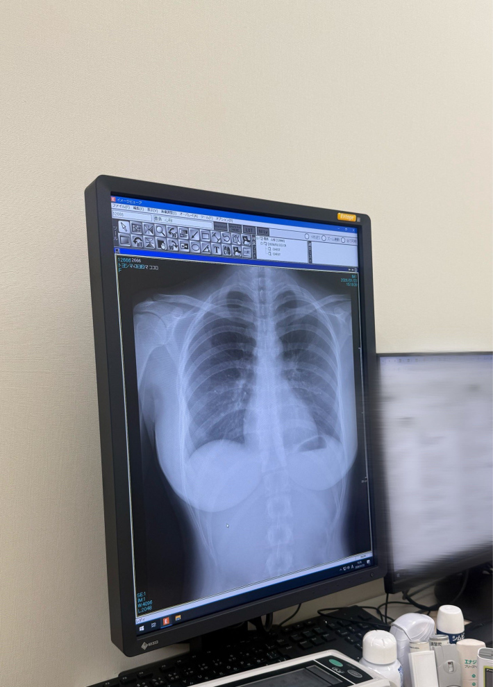 豊島心桜レントゲン写真0